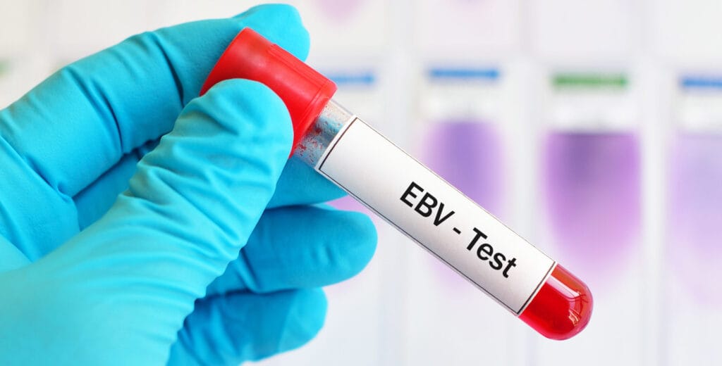 Private GP Birmingham Same day appointments blood tests vaccinations HayFever Injections Mounjaro Injection Open 7 days a week