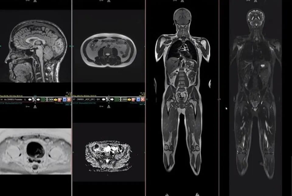 Full body mri same day gp clinic