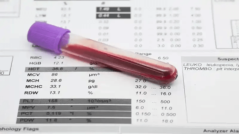 blood test result showing a blood test tube over the results list