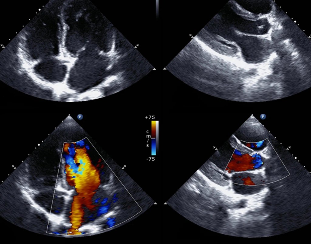 Private GP Birmingham Echocardiography